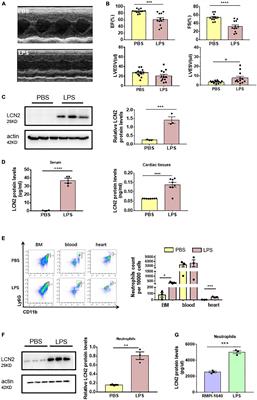 Lipocalin-2 in neutrophils induces ferroptosis in septic cardiac dysfunction via increasing labile iron pool of cardiomyocytes